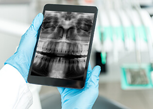 Dentist looking at x-ray on tablet