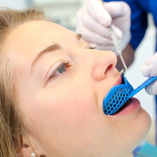 dentist in Marlton taking impressions of a patient’s teeth to make a nightguard