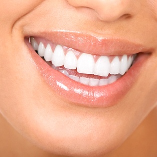 Close-up of woman’s bright smile with healthy teeth