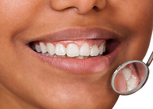 Healthy gum tissue reflected in dental mirror