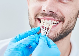 Gloved hands holding shade guide next to man’s teeth